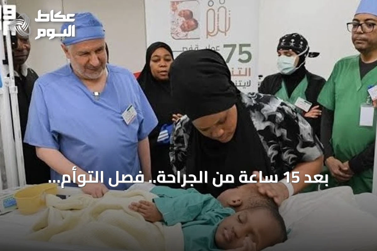 بعد 15 ساعة من الجراحة.. فصل التوأم التنزاني لايتيينس ولوفنس ضمن الحالة الـ75 للبرنامج السعودي
